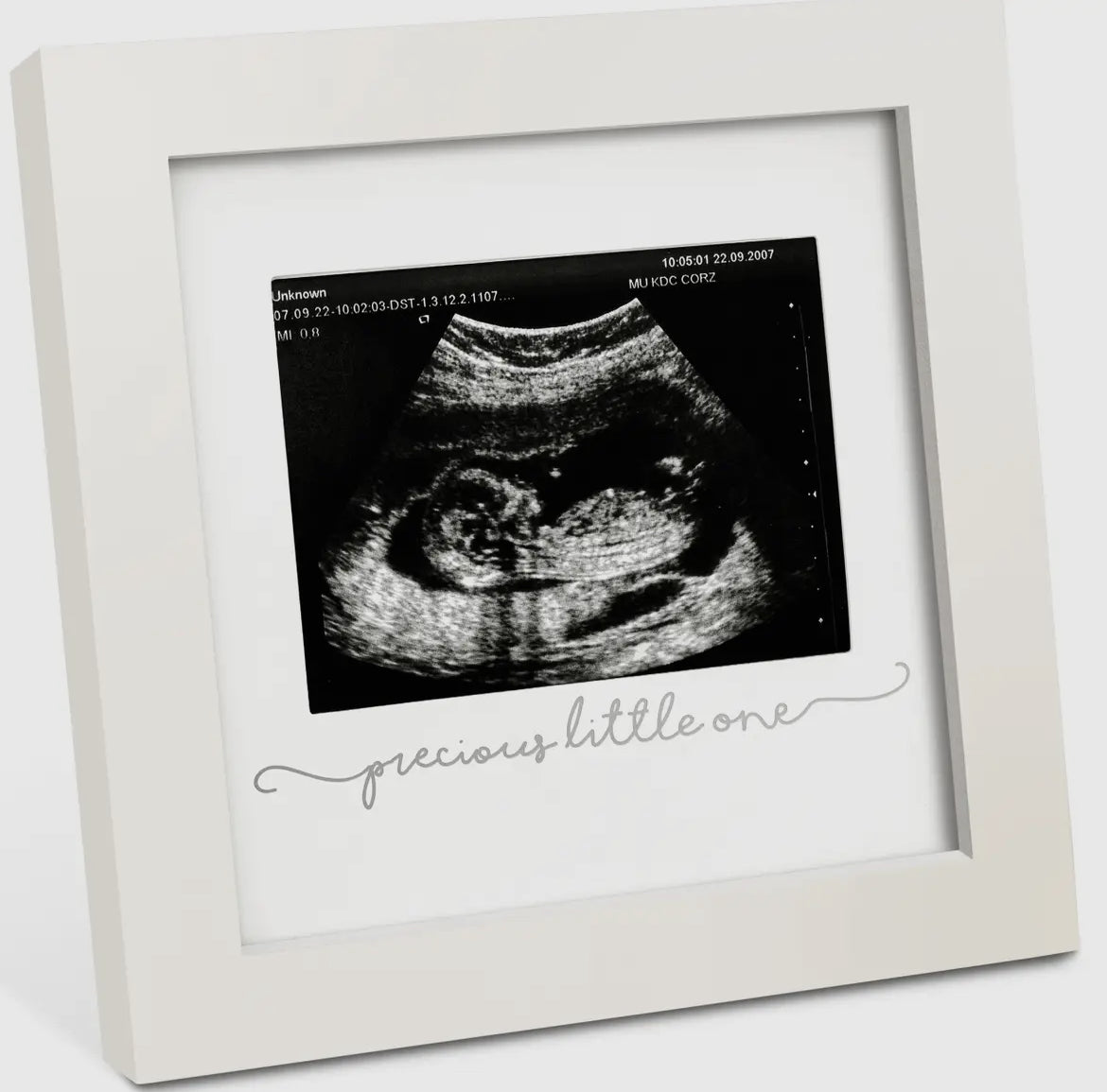 KeaBabies Solo Baby Sonogram
Picture Frame