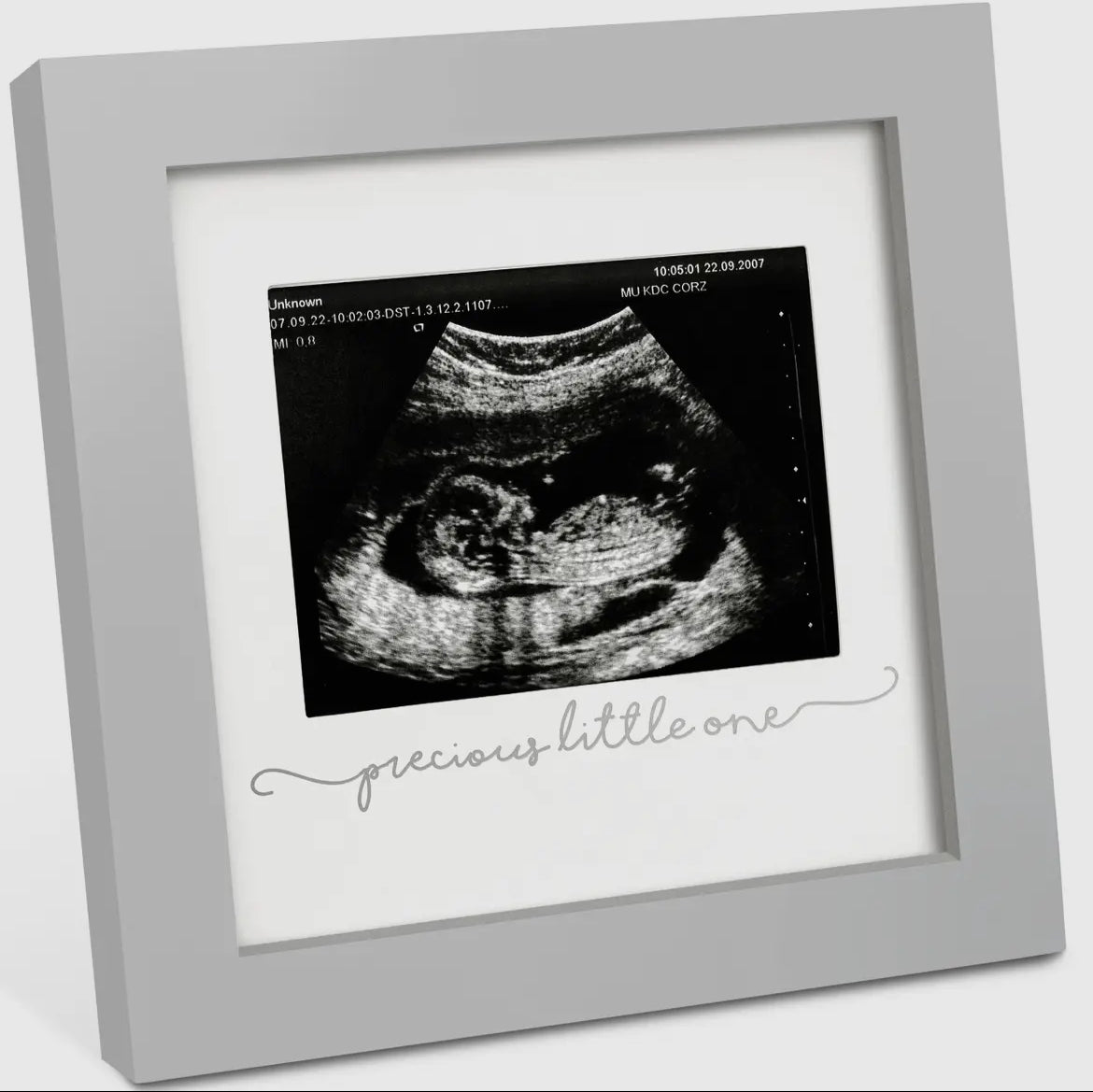 KeaBabies Solo Baby Sonogram
Picture Frame